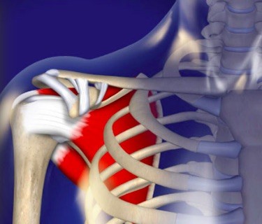 Ultrasound-Guided Injection for Shoulder Pain